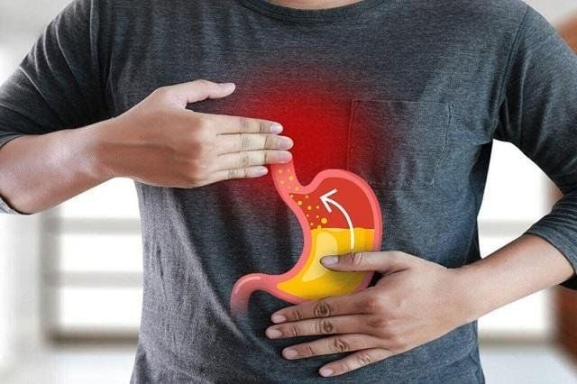 Nguyên nhân trào ngược dạ dày thường gặp và cách phòng ngừa hiệu quả