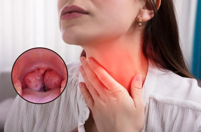 CỔ HỌNG NỔI HẠT LÀ DO ĐÂU VÀ CÁCH CHĂM SÓC