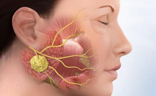 Ngăn ngừa bệnh quai bị ở nam giới.