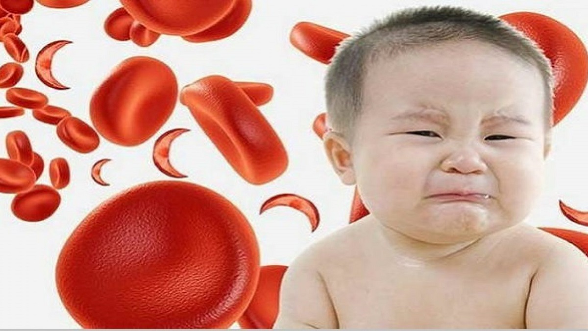 Trẻ thiếu máu cần bổ sung gì?